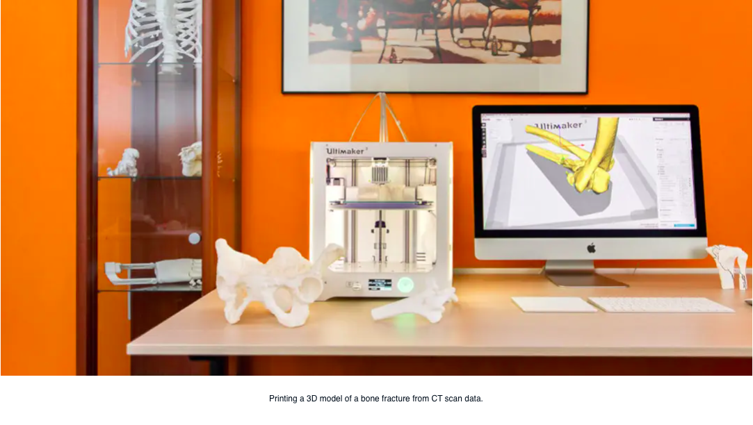 Vindecare mai rapidă, înțelegere mai clară a bolii - Beneficiilor fabricării aditivate pentru un spital de traumatologie