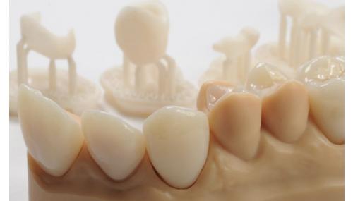 Stomatologie tech: dinți realizați prin fabricare aditivată și multe altele