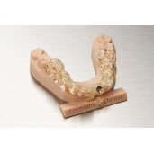 Rasina Formlabs Surgical Guide V1 1L (Form 4)